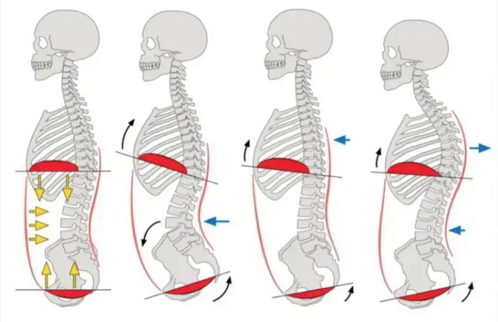 position du dos lors d'un bracing