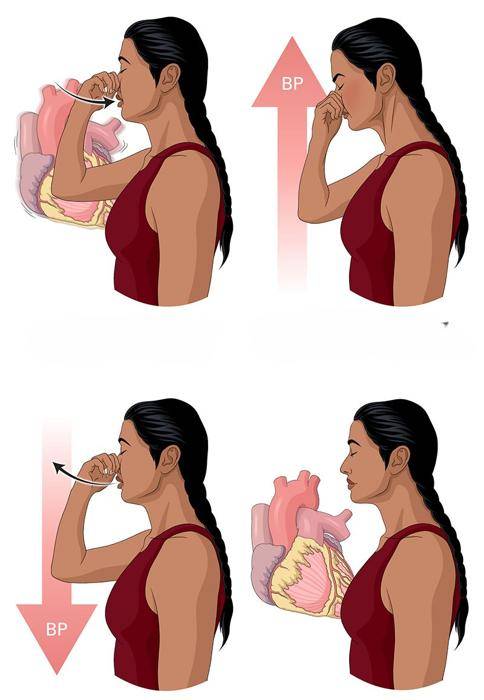 manoeuvre valsalva bracing