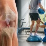 découvrez tout ce qu'il faut savoir sur la durée de récupération après une lésion des ligaments croisés du genou, les étapes clés et les conseils pour un rétablissement optimal.
